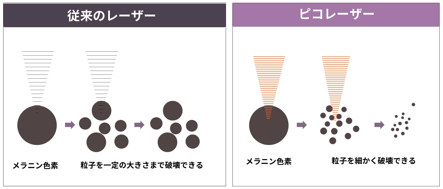 従来のレーザーとの違い