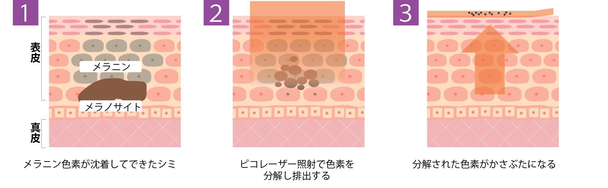 メラニン色素