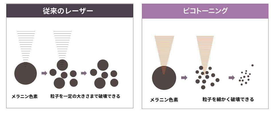 従来のレーザーとの違い